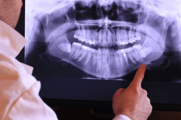 Best Holiday Emergency Dentist in Thomasboro, IL