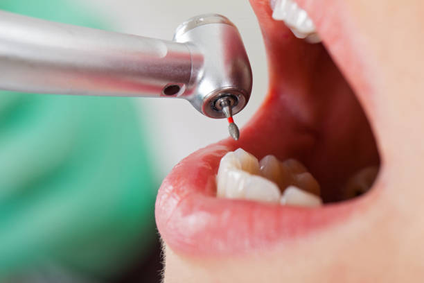 Best Emergency Dental Care for Abscessed Tooth in Thomasboro, IL